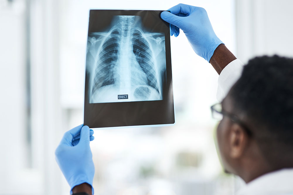 Shot of a young doctor analysing an x ray of a patient’s chest