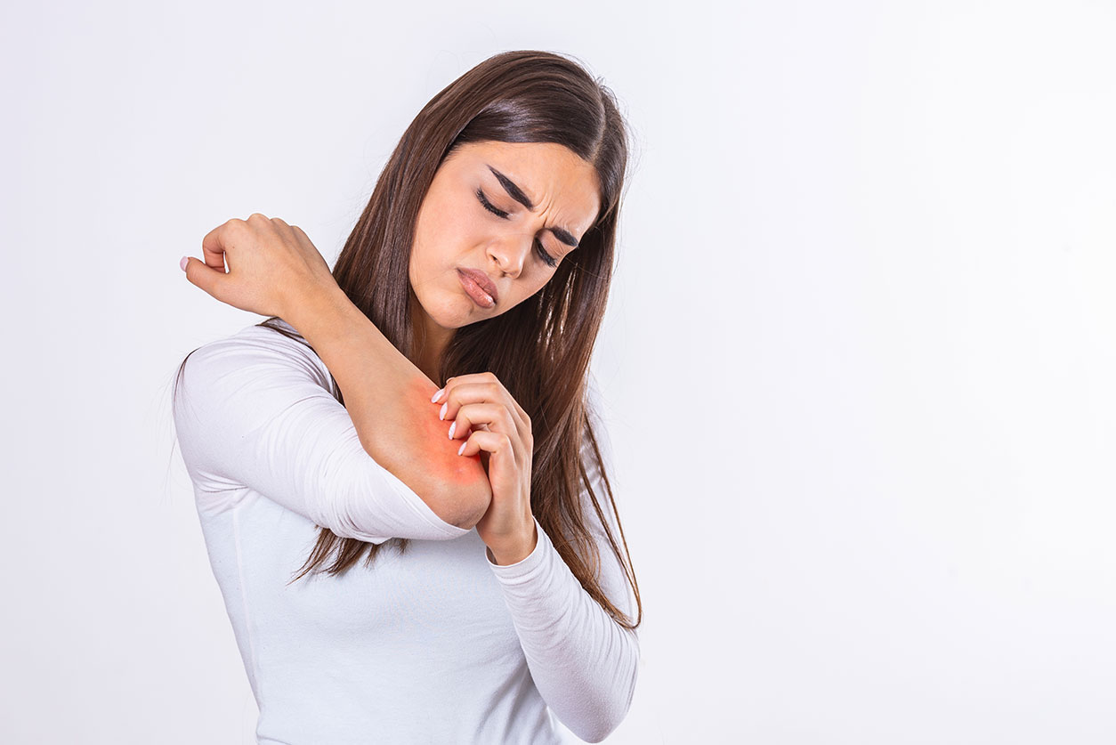 Young woman scratching her itchy arm. Skin problems and allergy. Healthcare and medical concept.