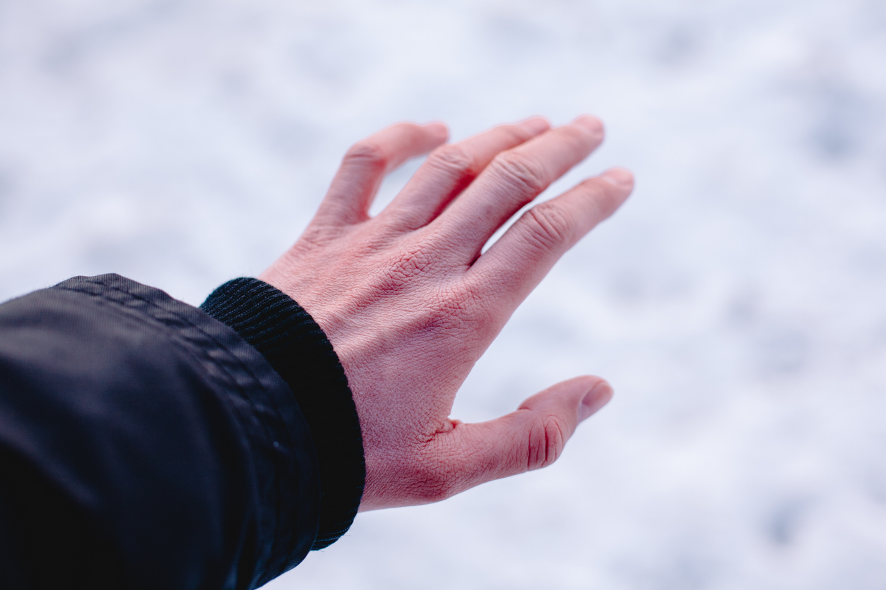 Risk of frostbite of hand because of frost in winter